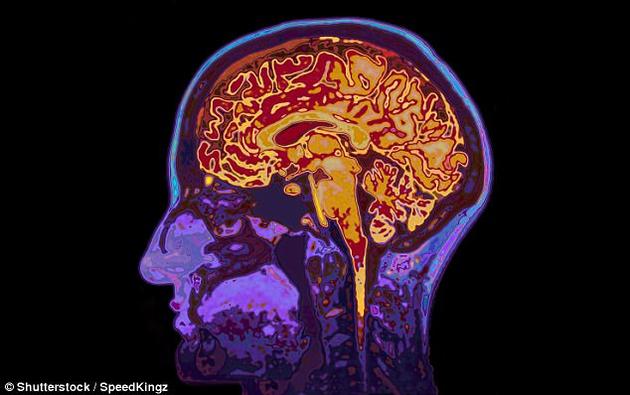 研究人员着重观察了三个脑区：背内侧前额叶皮质、尾状核、以及丘脑。