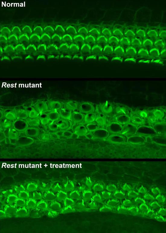 ▲与正常小鼠（上）相比，突变小鼠（中）的毛细胞结构出现明显异常。这一异常可以被小分子疗法（下）部分逆转（图片来源：Yoko Nakano， Carver College of Medicine， University of Iowa， first published in Cell）
